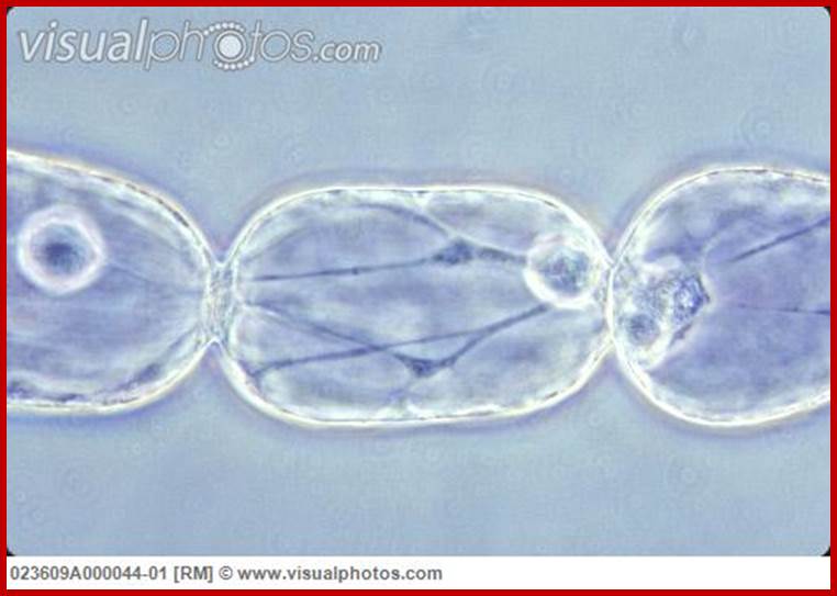 Tradescantia stamen hair cell in cyclosis.